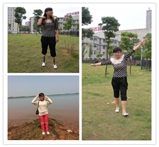 雙小腿裝配假肢案例|下肢假肢裝配案例