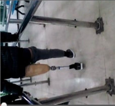 初裝大腿假肢步行訓練視頻|佳滿假肢
